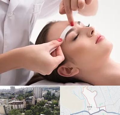 اپیلاسیون در اوین