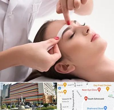 اپیلاسیون در سهروردی 