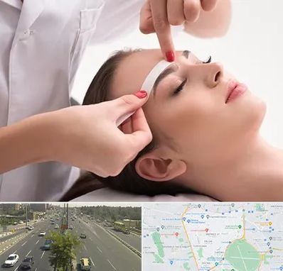 اپیلاسیون در منطقه 17 تهران