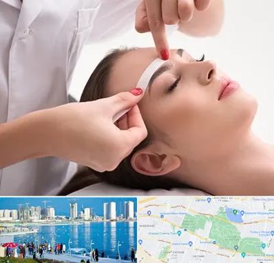 اپیلاسیون در چیتگر 