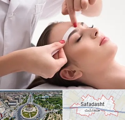 اپیلاسیون در صفادشت