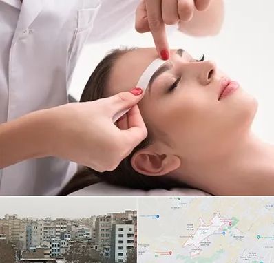 اپیلاسیون در محمد شهر کرج