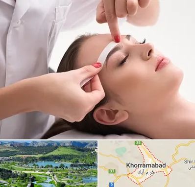 اپیلاسیون در خرم آباد