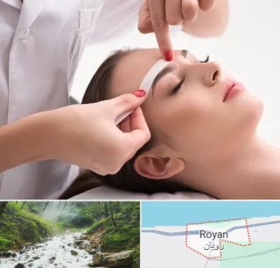 اپیلاسیون در رویان