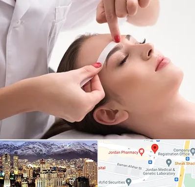 اپیلاسیون در جردن 