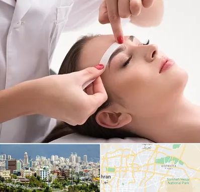 اپیلاسیون در شرق تهران 