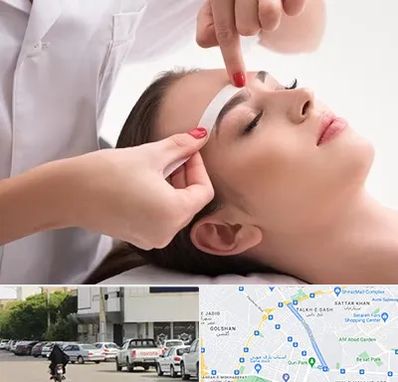 اپیلاسیون در قدوسی شرقی شیراز