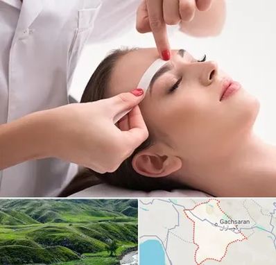 اپیلاسیون در گچساران