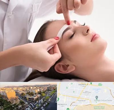 اپیلاسیون در تهرانپارس 