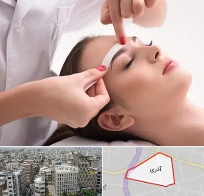 اپیلاسیون در آذری