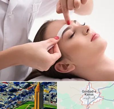 اپیلاسیون در گنبد کاووس