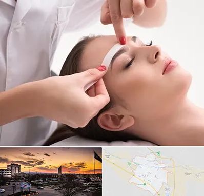 اپیلاسیون در قوچان