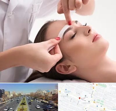 اپیلاسیون در بلوار معلم مشهد