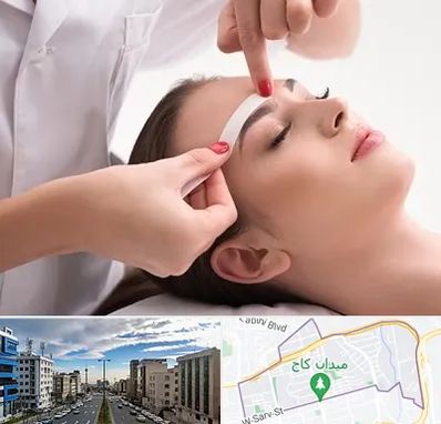 اپیلاسیون در سعادت آباد 