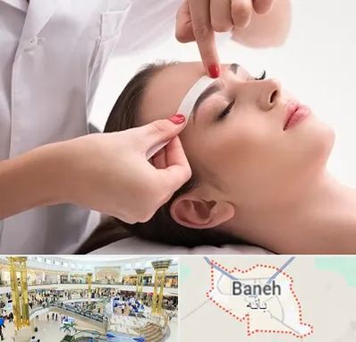 اپیلاسیون در بانه