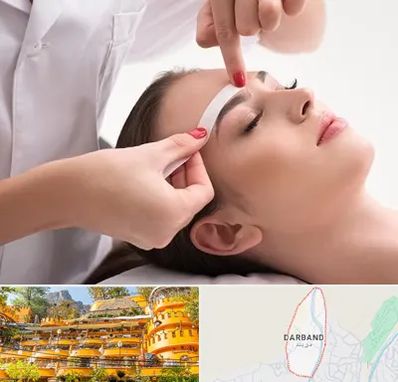 اپیلاسیون در دربند