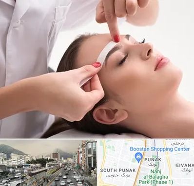 اپیلاسیون در پونک 