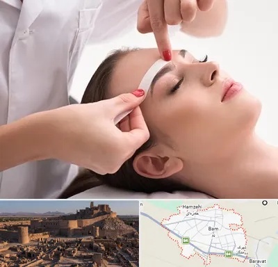 اپیلاسیون در بم