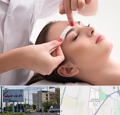 اپیلاسیون در فاز یک اندیشه