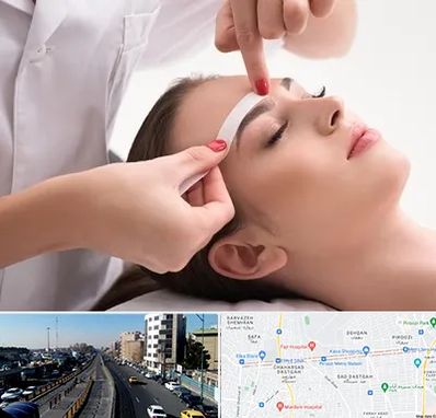 اپیلاسیون در پیروزی 