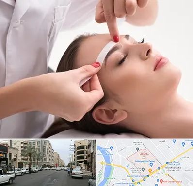 اپیلاسیون در زیتون کارمندی اهواز