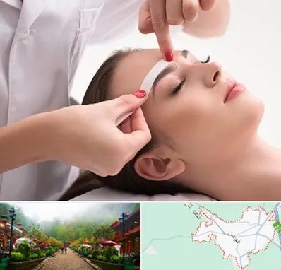 اپیلاسیون در فومن