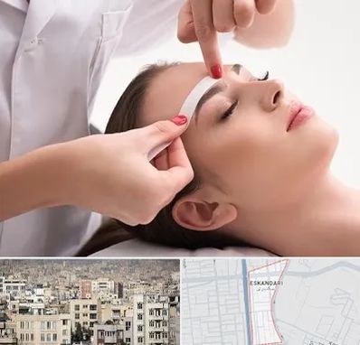 اپیلاسیون در اسکندری