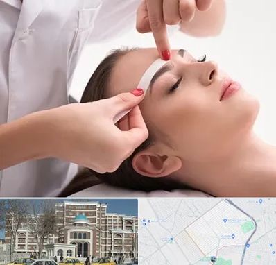 اپیلاسیون در طلاب مشهد