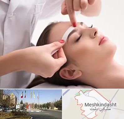 اپیلاسیون در مشکین دشت