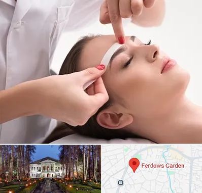 اپیلاسیون در باغ فردوس