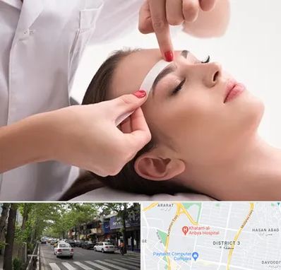 اپیلاسیون در ظفر 