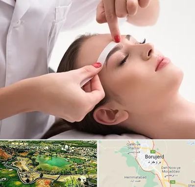 اپیلاسیون در بروجرد