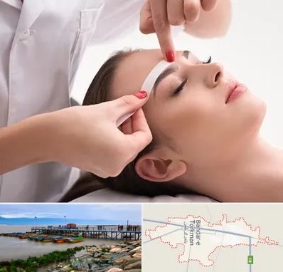 اپیلاسیون در بندر ترکمن