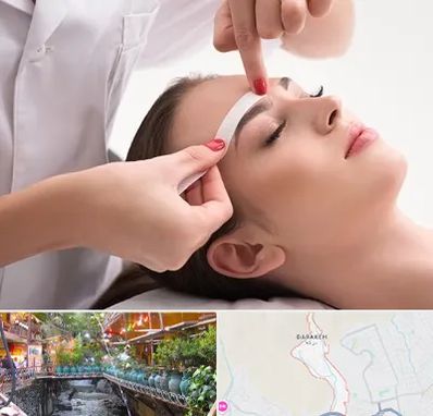 اپیلاسیون در درکه
