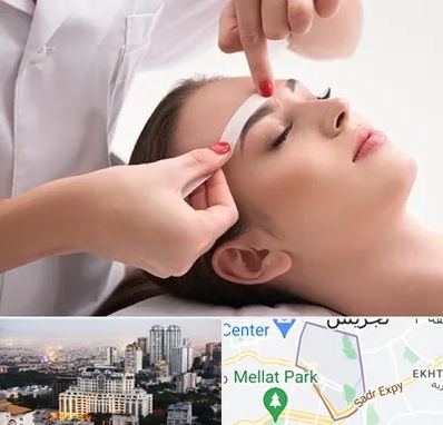 اپیلاسیون در الهیه 