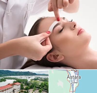 اپیلاسیون در آستارا