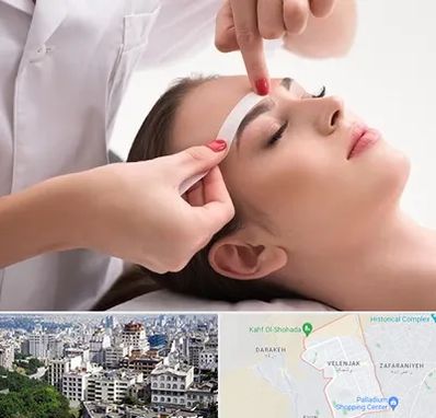 اپیلاسیون در ولنجک 