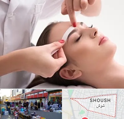 اپیلاسیون در شوش
