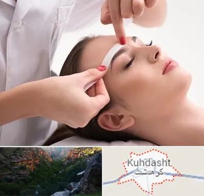 اپیلاسیون در کوهدشت