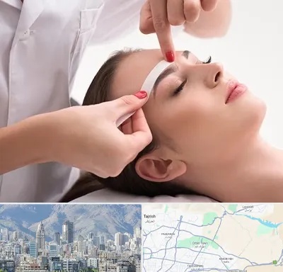 اپیلاسیون در شمال شرق تهران