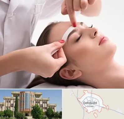 اپیلاسیون در دهدشت
