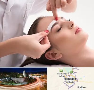 اپیلاسیون در همدان