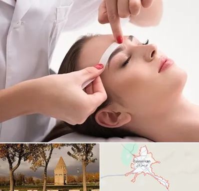 اپیلاسیون در تویسرکان