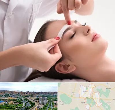 اپیلاسیون در شهریار