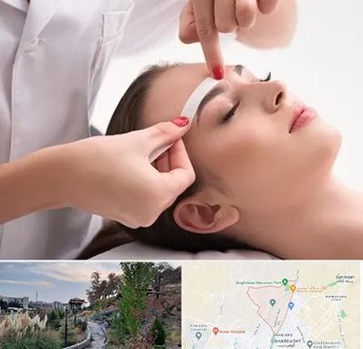 اپیلاسیون در باغستان کرج