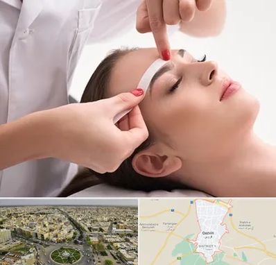 اپیلاسیون در قزوین