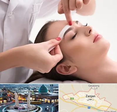 اپیلاسیون در زنجان