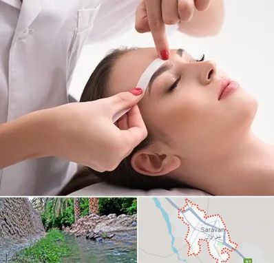 اپیلاسیون در سراوان