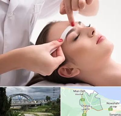 اپیلاسیون در چالوس