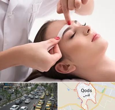 اپیلاسیون در شهر قدس